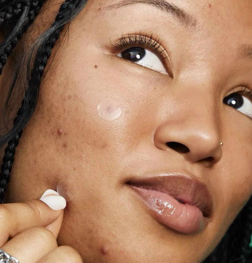 e.l.f. Cosmetics Blemish Breakthrough Stick It to Zits Pimple Patches