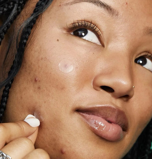 e.l.f. Cosmetics Blemish Breakthrough Stick It to Zits Pimple Patches