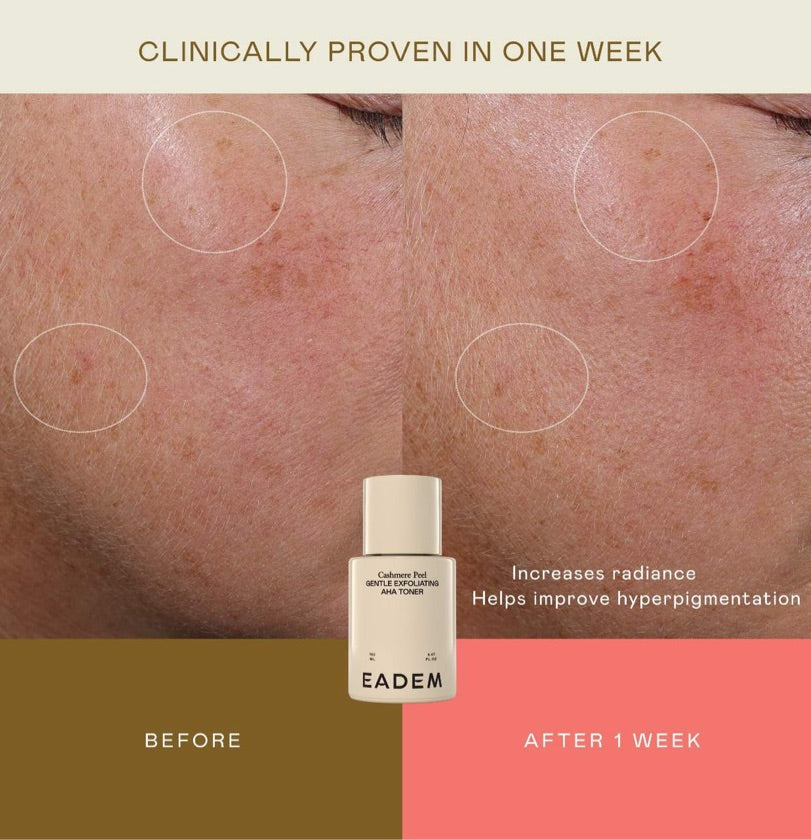 EADEM CASHMERE PEEL